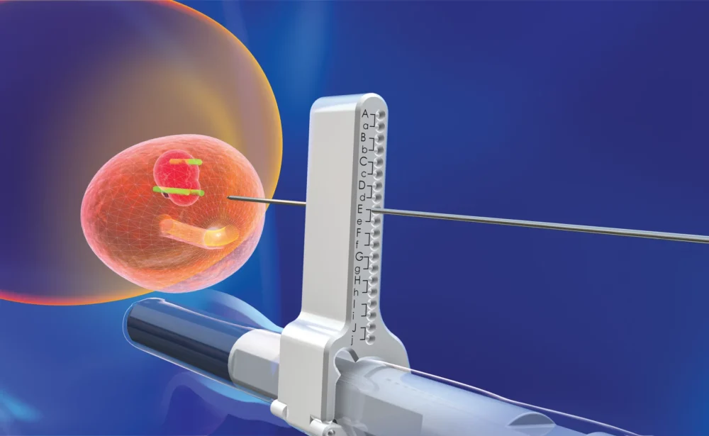transperineal biopsy trinity