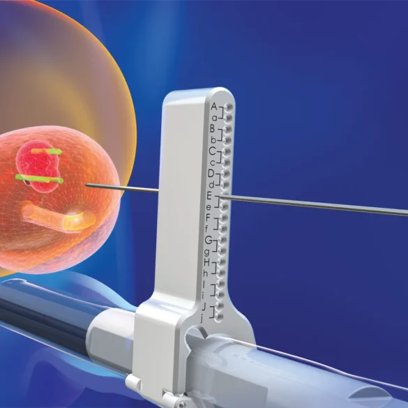 transperineal biopsy trinity