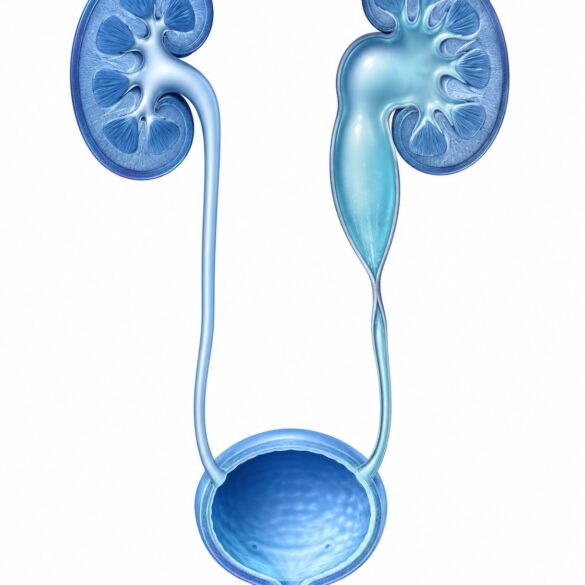 ureter darligi